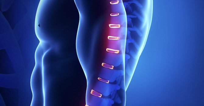 Pinched Nerve vs Herniated Disc: Key Symptoms & Relief image