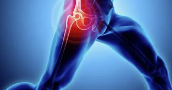 Hip Pain and Sciatica: Causes and Their Connection