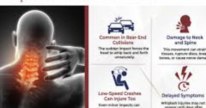 Does Scoliosis Affect Injury Risk During a Car Accident? Biomechanical Considerations