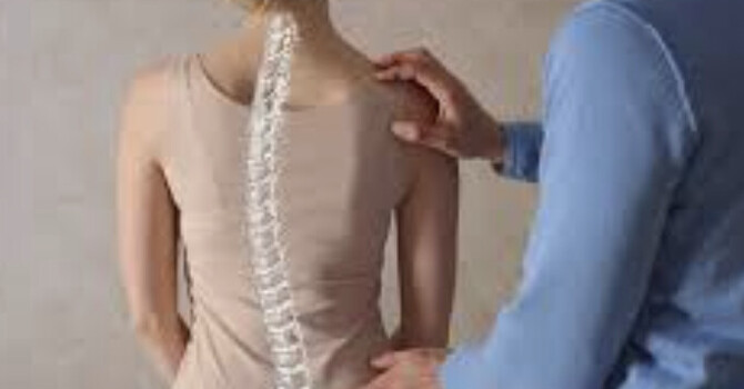 Understanding Scoliosis Biomechanics: Sagittal Alignment, Cervical Mechanics, and Structural Spinal Balance