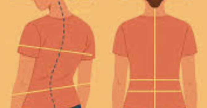 The Role of the Labyrinthine Righting Reflex in Scoliosis: A Neurological Perspective