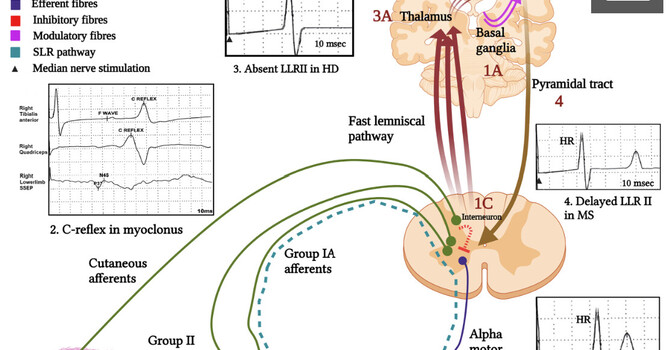 Clear Life Scoliosis Featured in National Publication for Groundbreaking Scoliosis Research